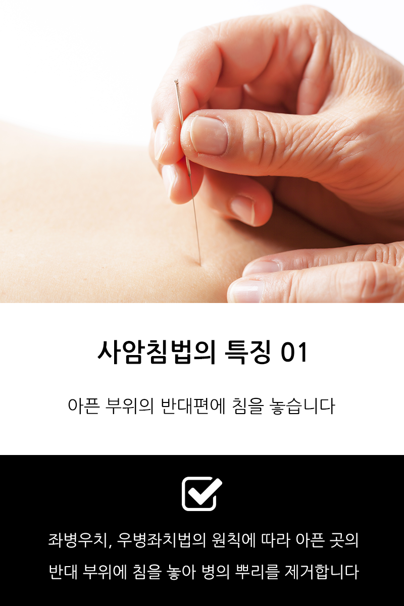 사암침법 : 고운누리한의원 부천본원