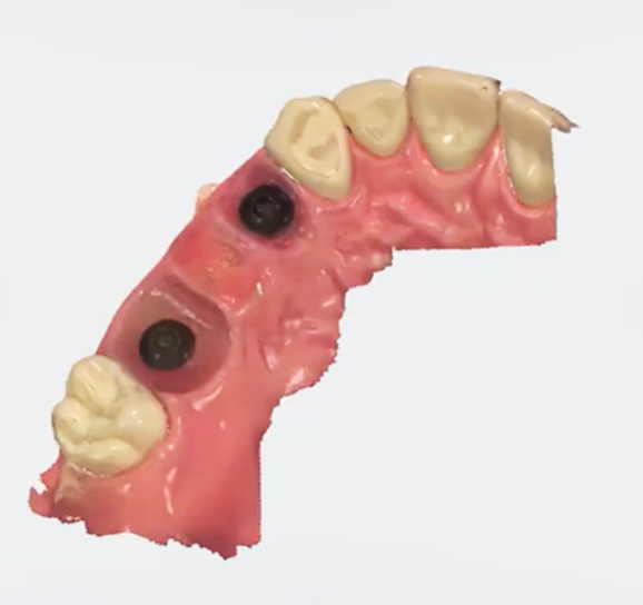 fea6695df778d.png