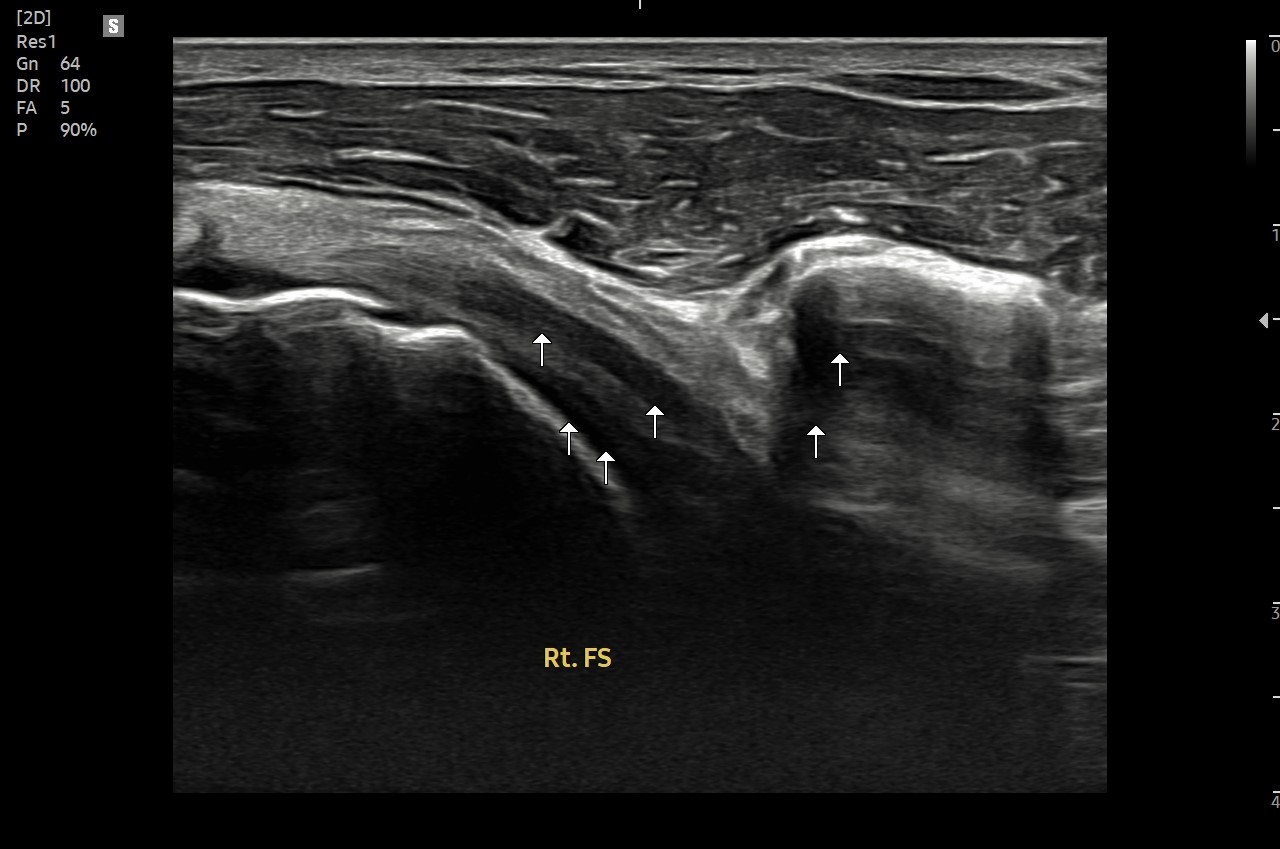 1751b5f227feb.jpg