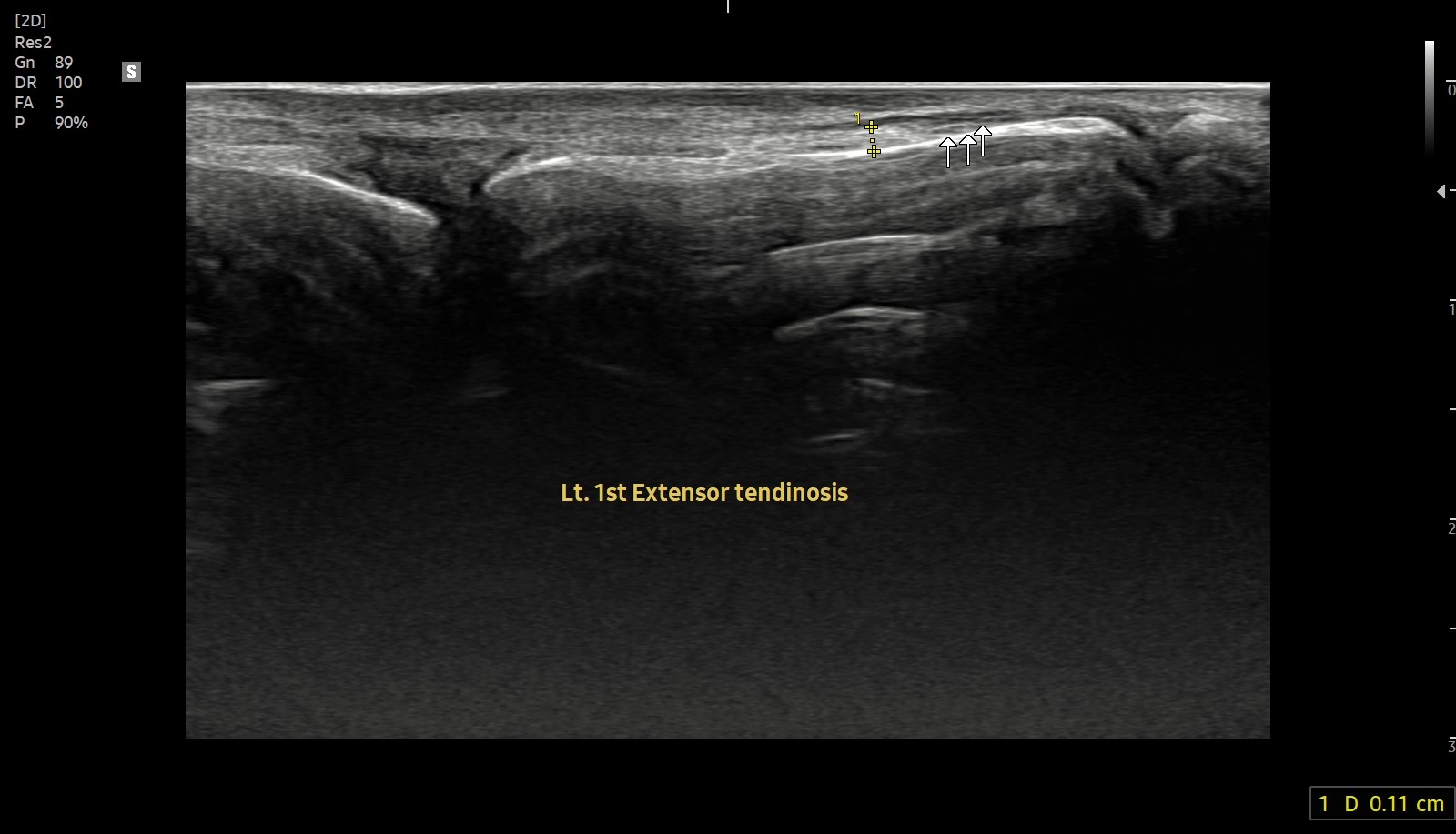 1b27632c916ab.jpg