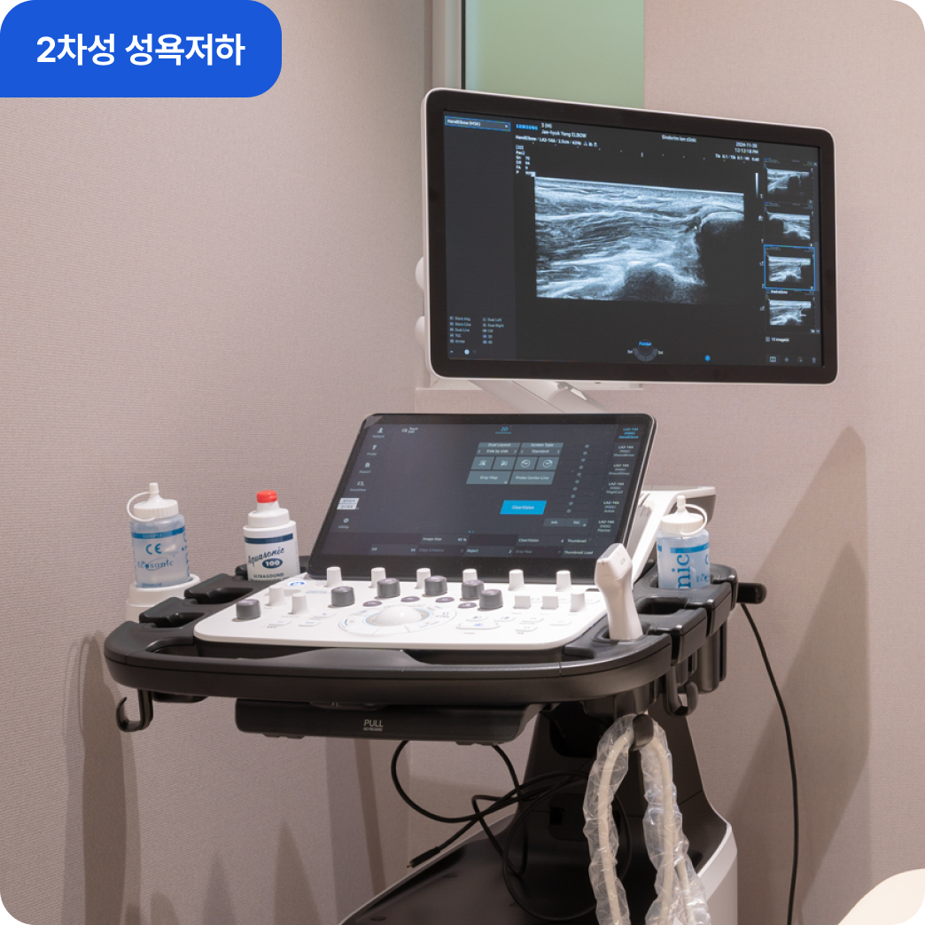 2차성 성욕저하 정밀 초음파 검사