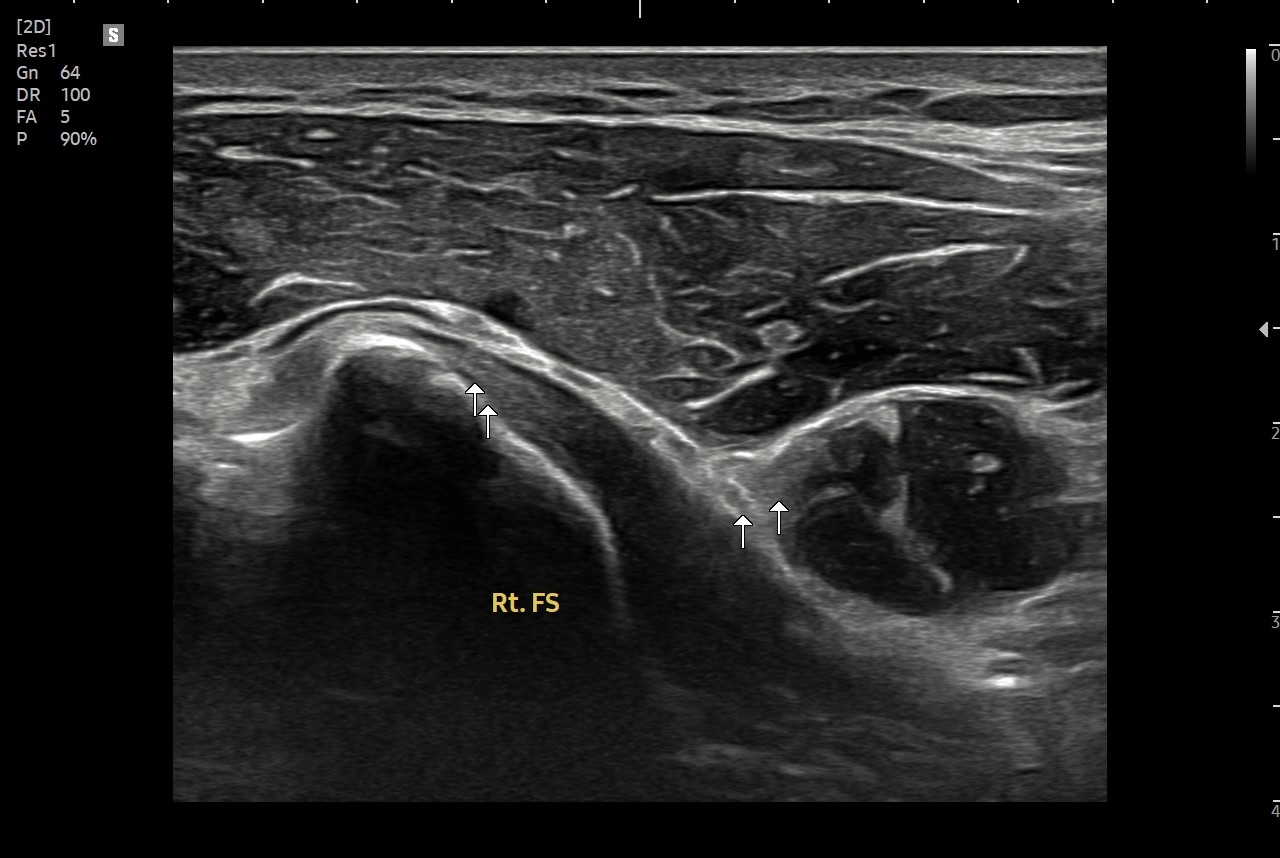 864abf1734020.jpg