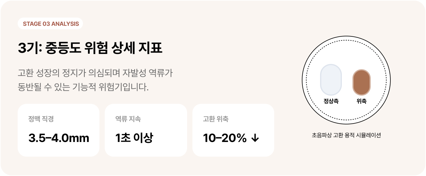 정계정맥류 3기: 중등도 위험 상세 지표 - 비직선적 구불거림이 관찰되기 시작하며 Valsalva 검사 시(복압을 주는 검사) 명확한 역류가 나타납니다.