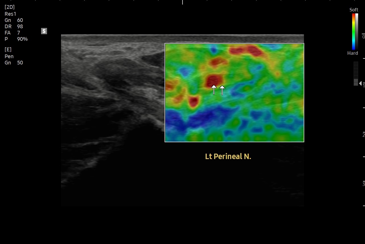 9b1ab597955b7.jpg
