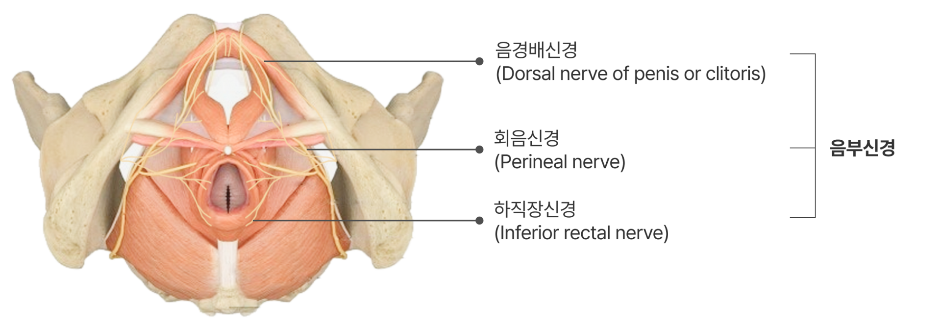 여성 회음부 통증 해부학 이미지