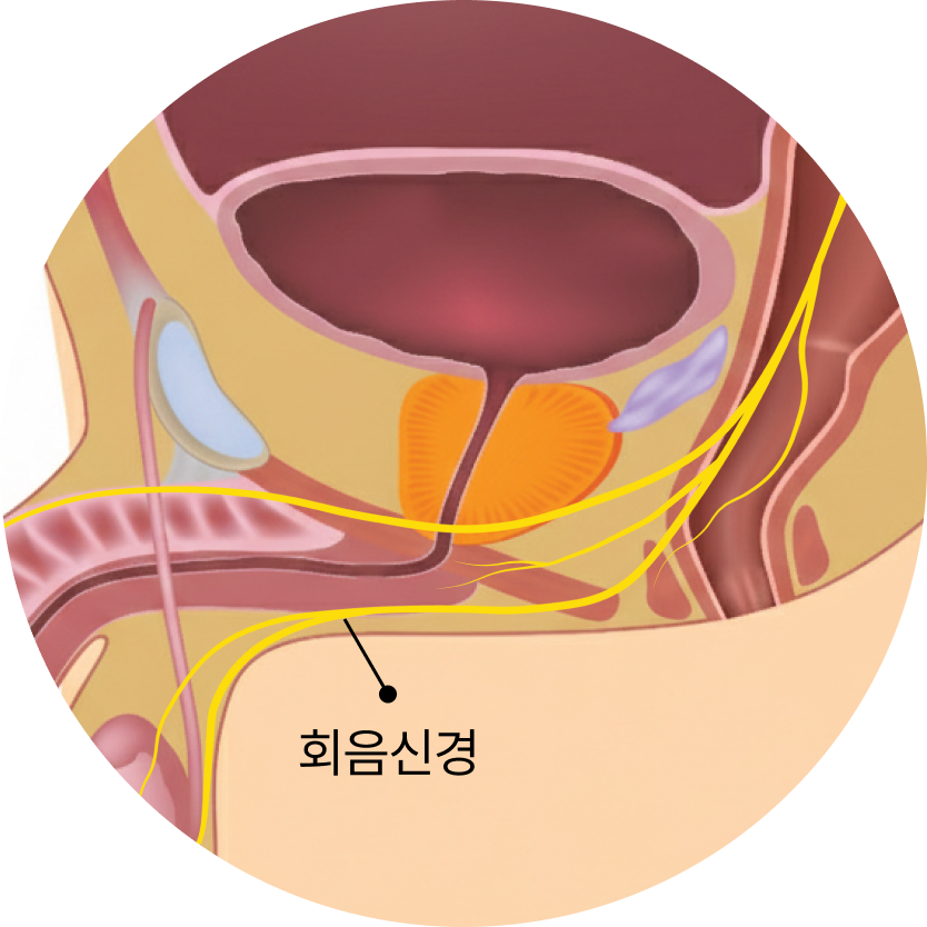 남성 기능 질환 - 2차성 성욕저하 해부학 이미지