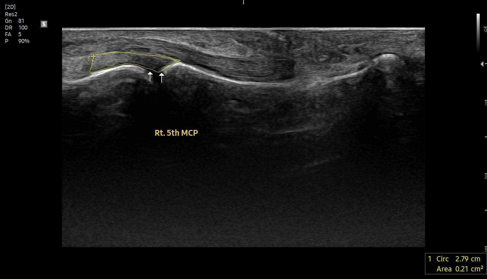 ed75acf5b2647.jpg