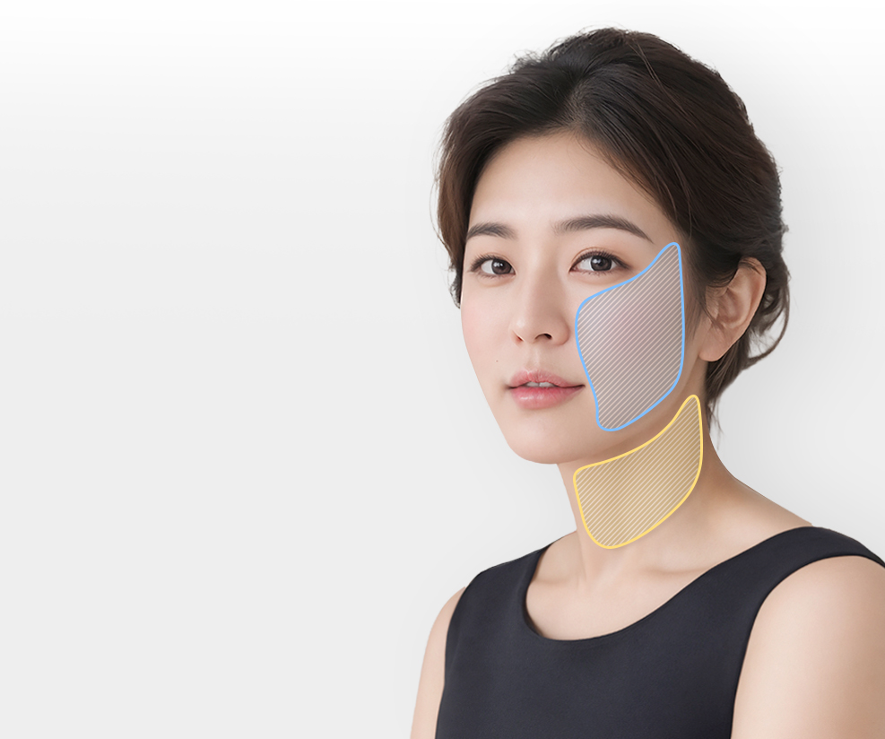 안면거상,목거상