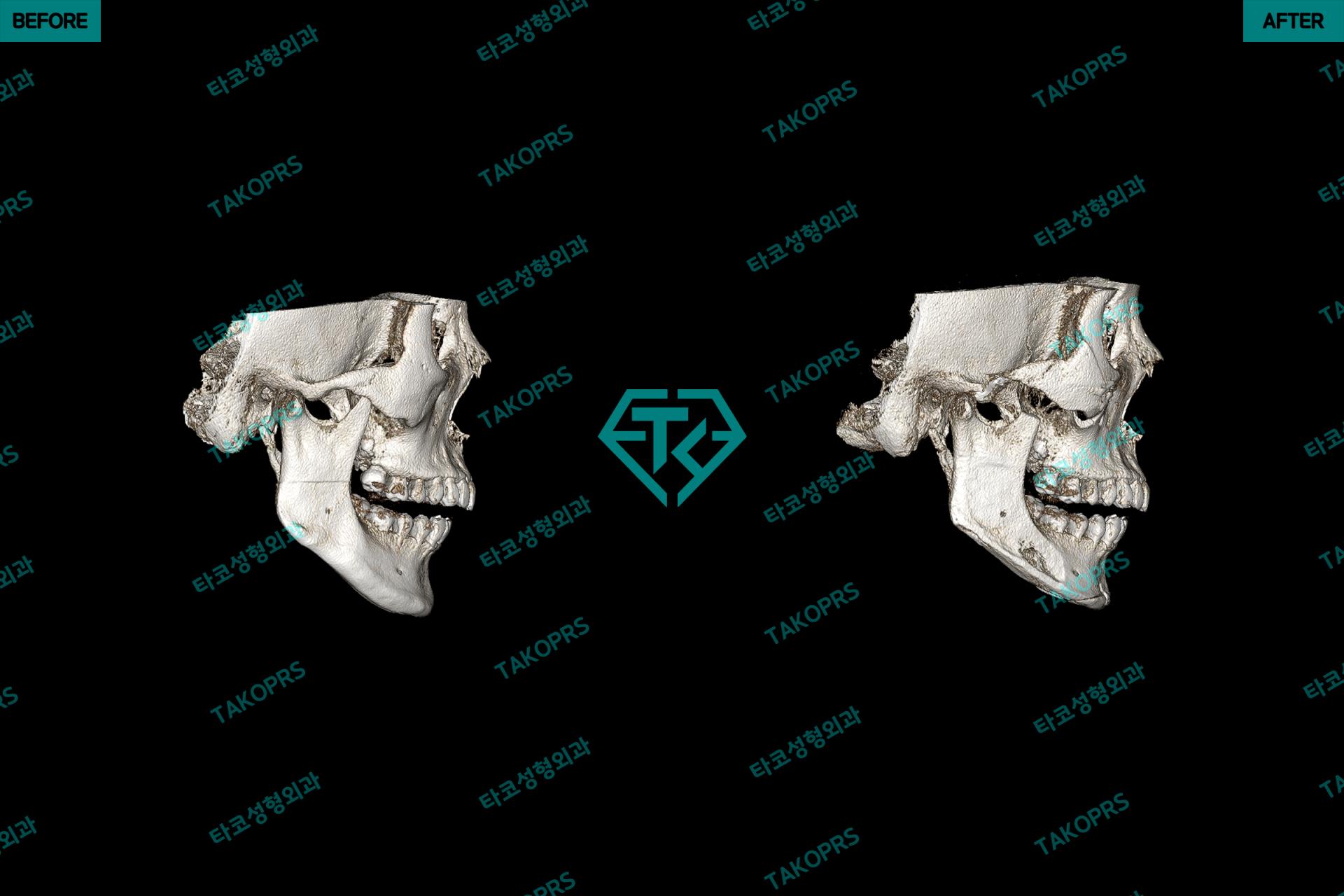 510dfd6658660.jpg