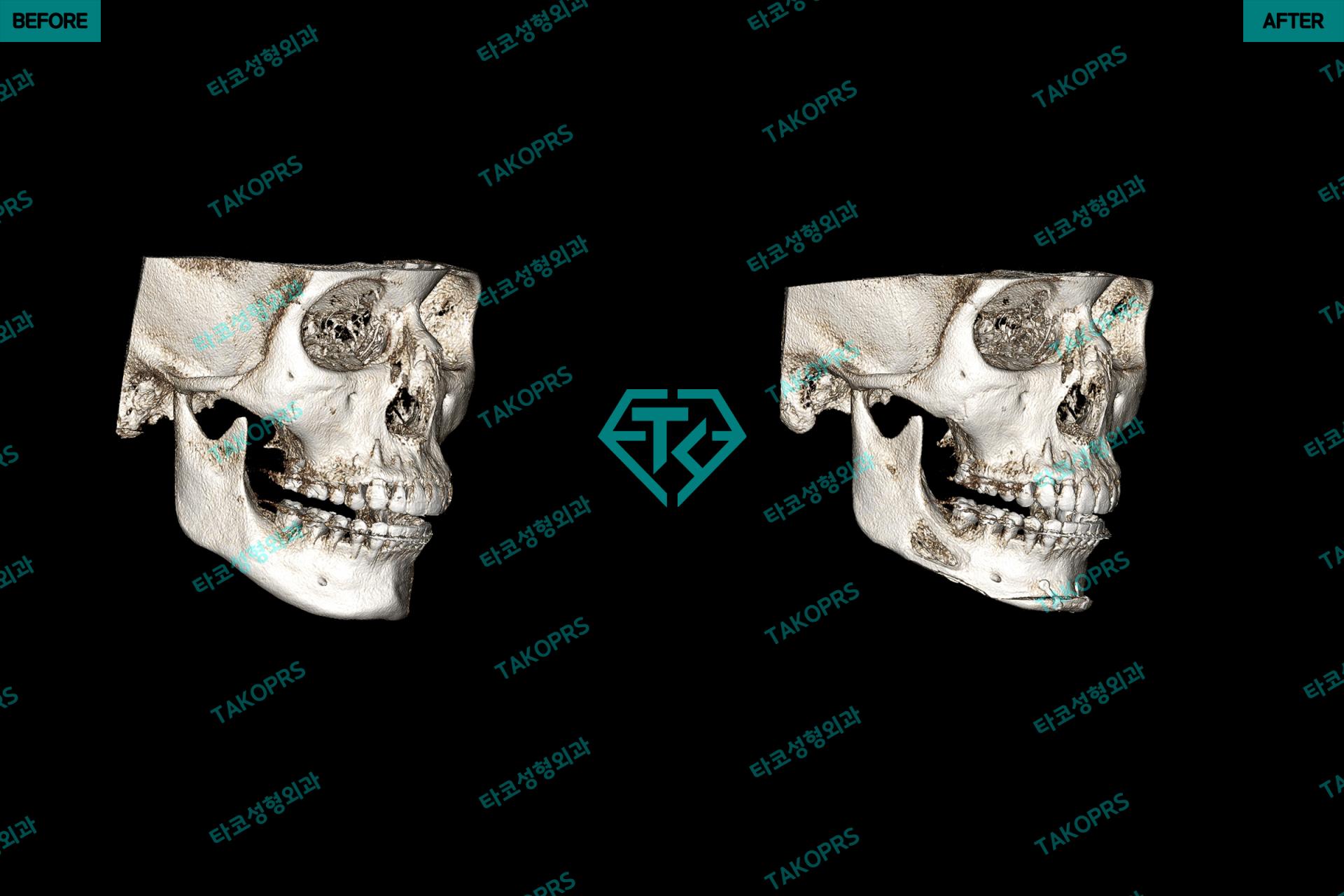 a0f1ed11eb62d.jpg