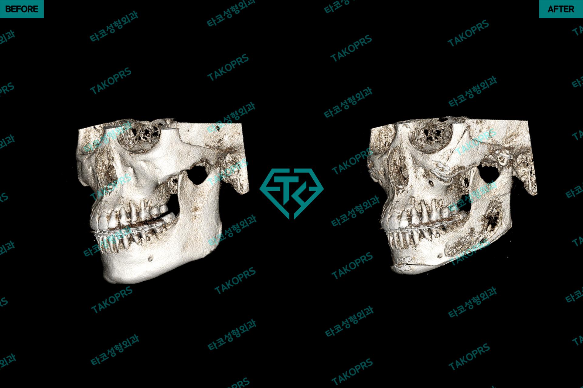 d5961a60aed25.jpg
