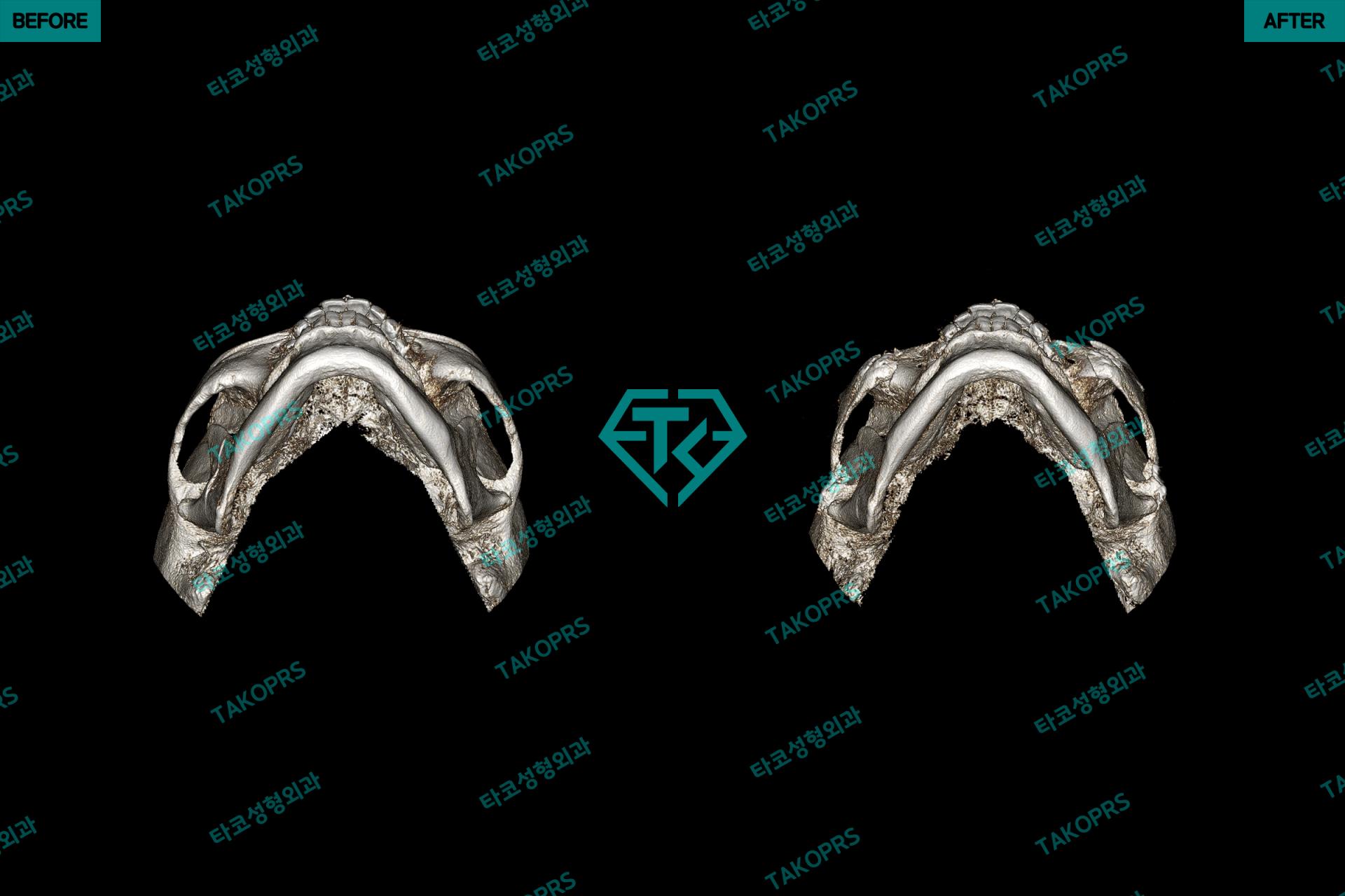 fdf33e0b90888.jpg