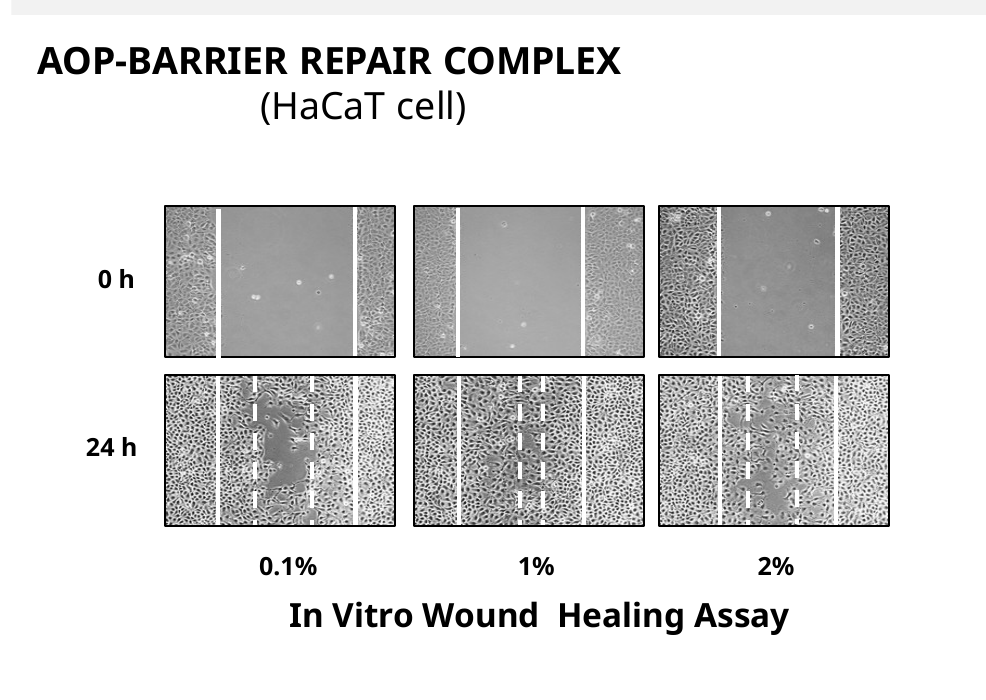 HaCaT 세포 wound healing assay