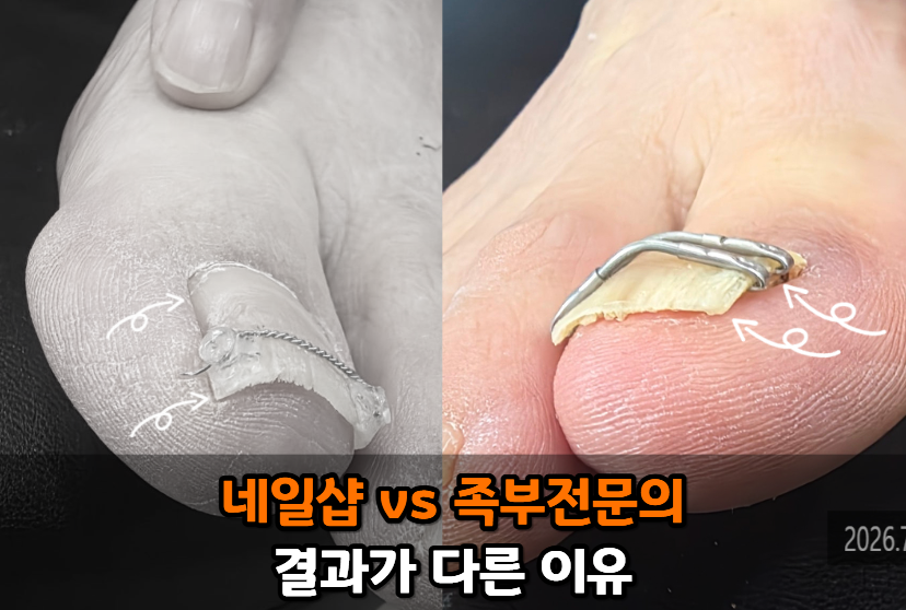 385bcd268223d.png