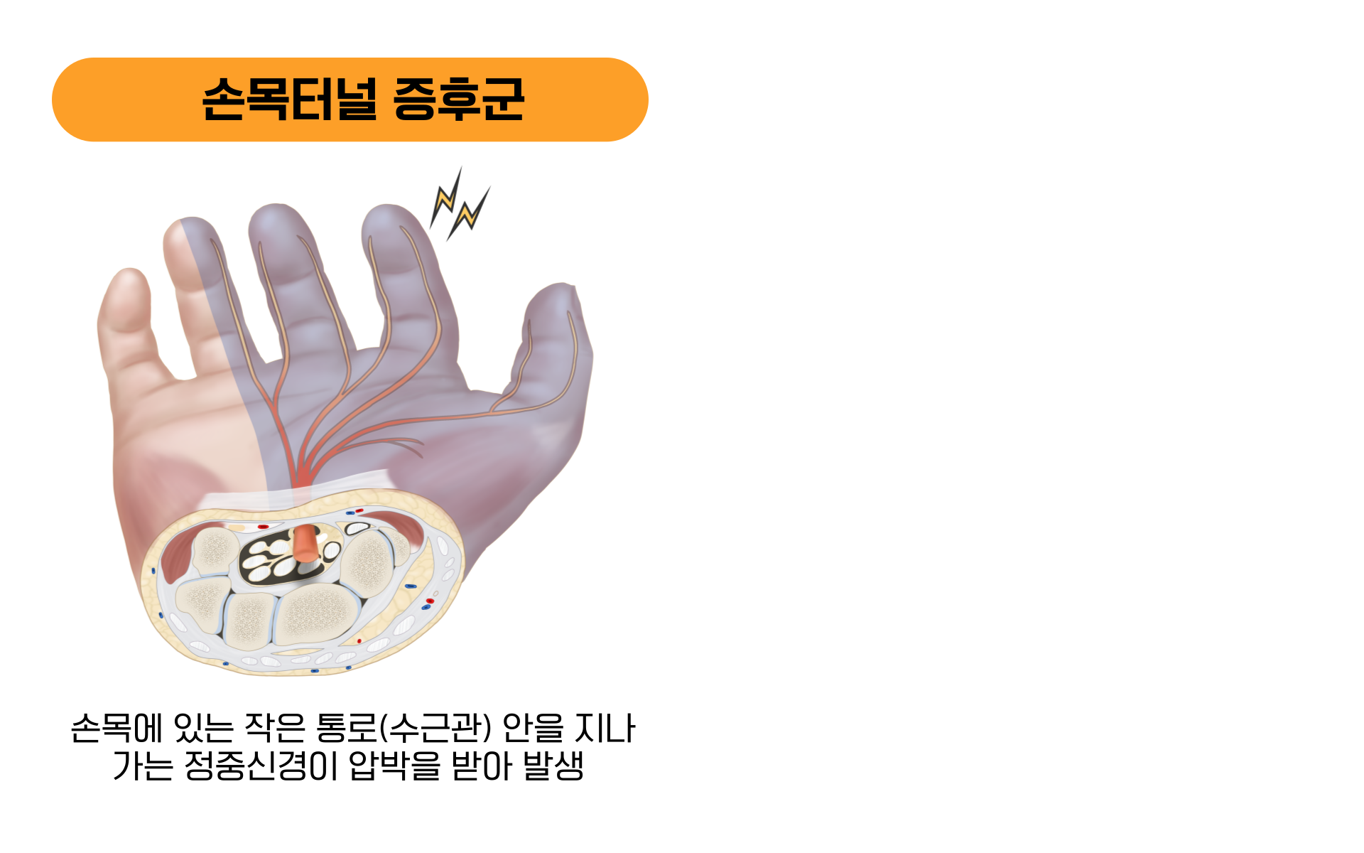 8fd876a04923e.png