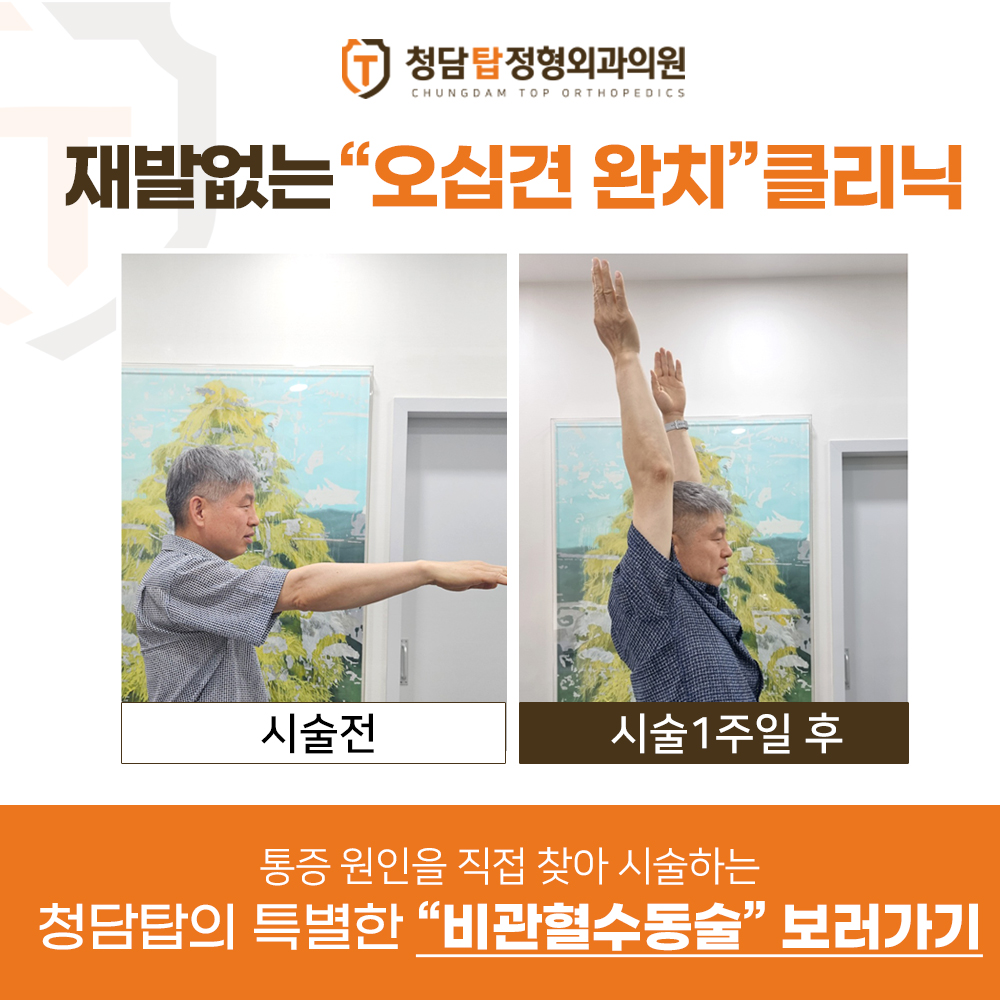 오십견완치 클리닉
