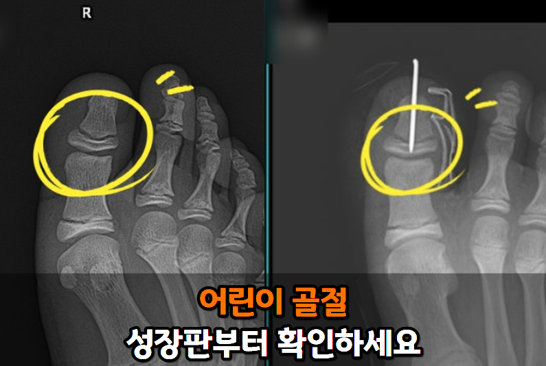 f289998ef2870.png