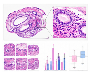 오가노이드 H&E pathology interpretation 예시