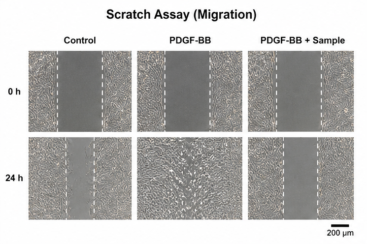 VSMC Scratch Assay migration 결과 예시