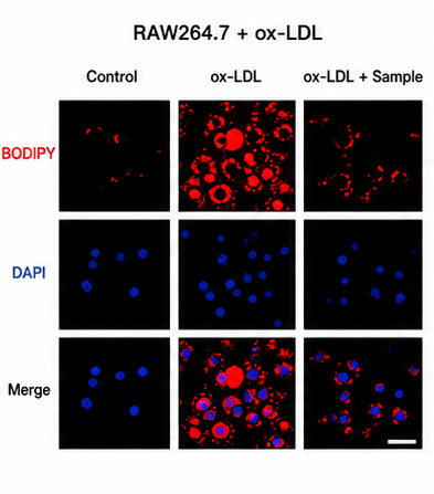 RAW264.7 ox-LDL Foam Cell Formation Image 예시