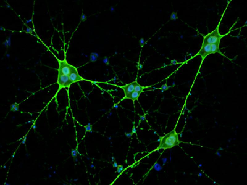 Primary Hippocampal Neuron image