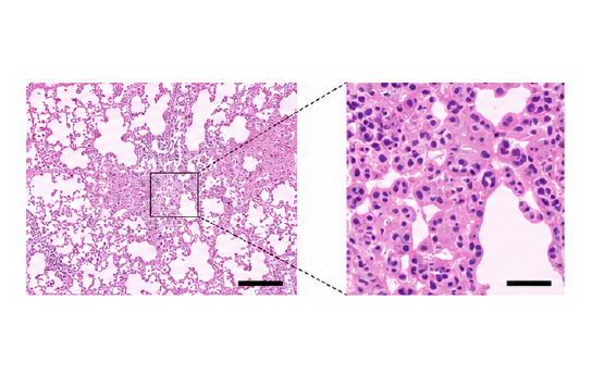 DDS H&E tissue analysis 결과 예시