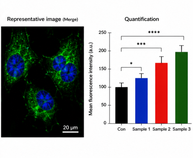Intensity and report image