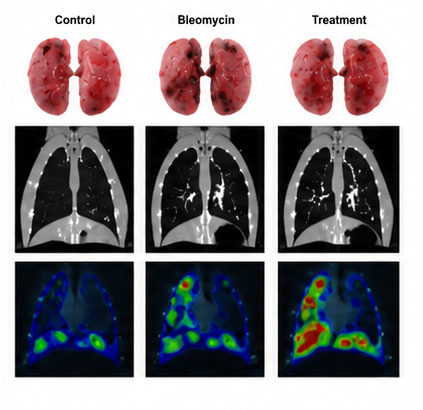 CT / SPECT Imaging 폐 병변 영상 예시