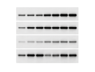 Western blot 단백질 분석