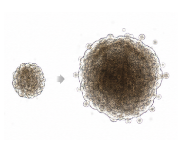 Organoid growth change 결과 예시