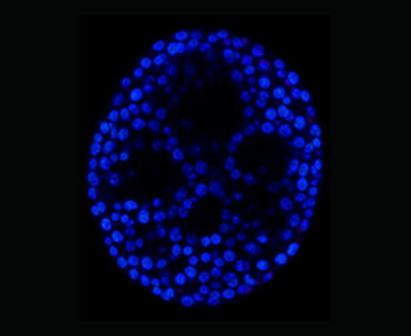 오가노이드 DAPI 형광 이미지 예시