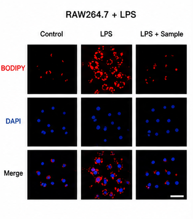 RAW264.7 LPS Lipid Droplet Image 예시