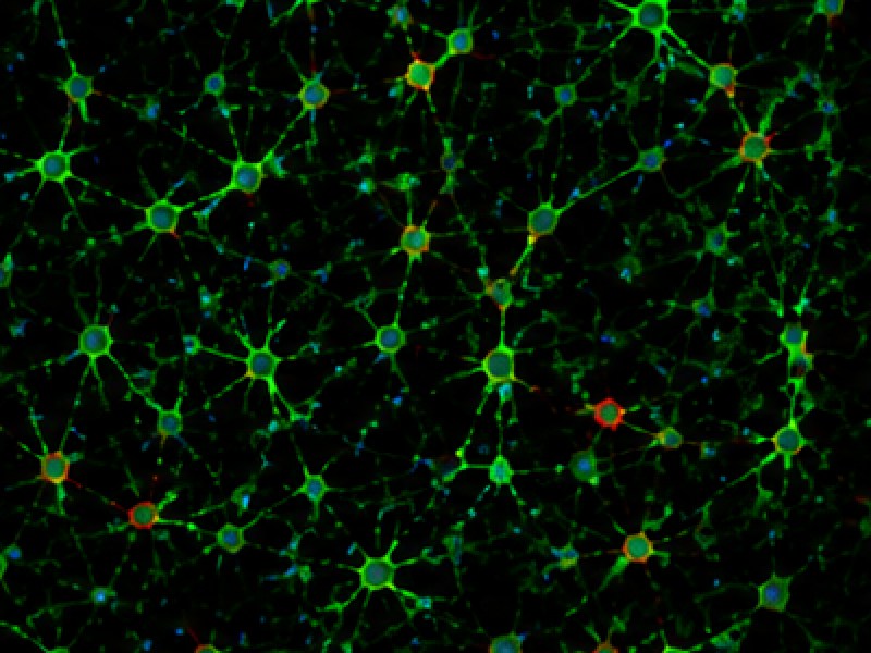 Primary Cerebellar Granule Neuron image