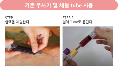 기존 주사기 및 채혈 tube 사용 예시 이미지
