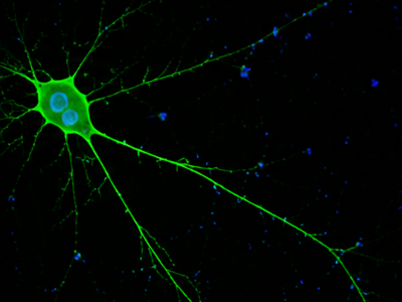 DRG Neuron image