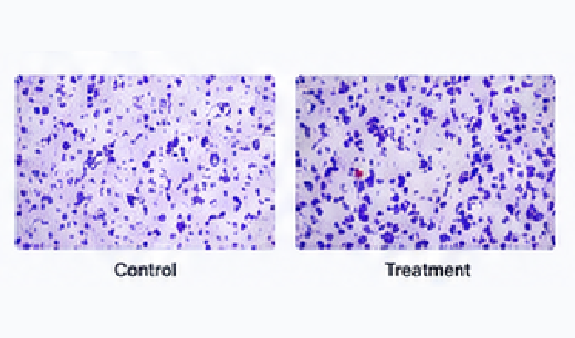 Invasion assay image