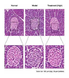 혈당 조절 동물모델 췌장 H&E insulin IHC 조직 이미지 예시