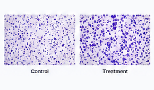 Transwell migration assay image