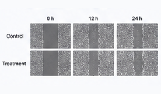 Scratch wound healing microscopy image