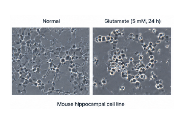 HT22 glutamate 유도 신경독성 모델 이미지