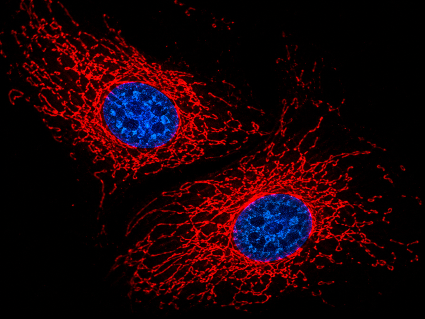 Scratch wound healing microscopy image