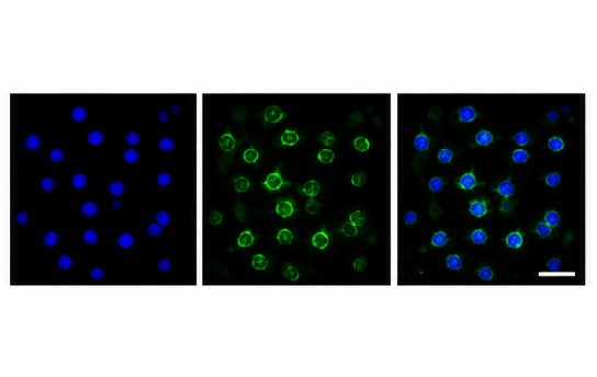 DDS cell uptake imaging 결과 예시