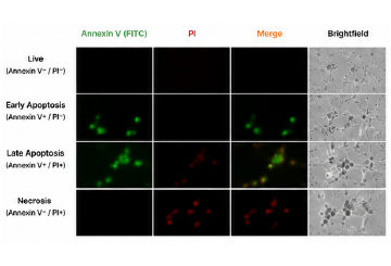 Annexin V PI 형광염색 결과 예시