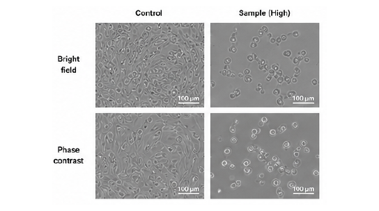 Morphology Analysis 세포 형태 분석 결과 예시