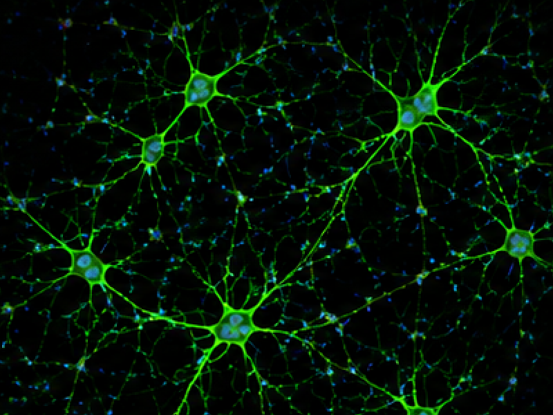 Primary Cortical Neuron image