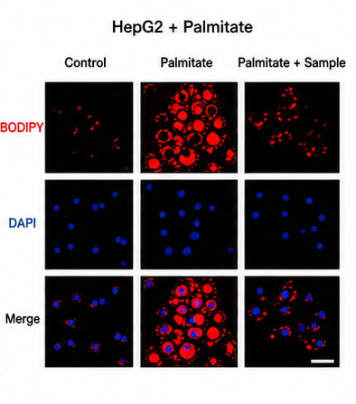 HepG2 Palmitate Lipogenesis Image 예시