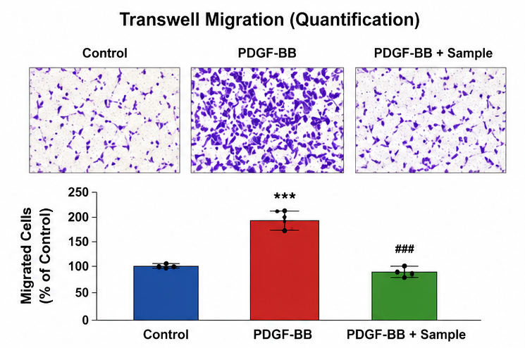 VSMC Transwell Migration 정량 결과 예시