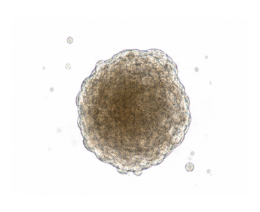 Spheroid morphology 결과 예시