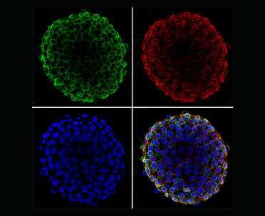Organoid marker analysis 결과 예시