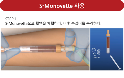 S-Monovette 사용 예시 이미지